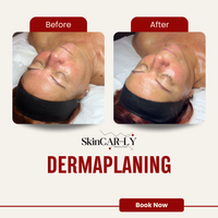 Dermaplaning (The Restart Facial)