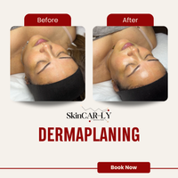 Dermaplaning (The Restart Facial)