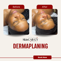 Dermaplaning (The Restart Facial)